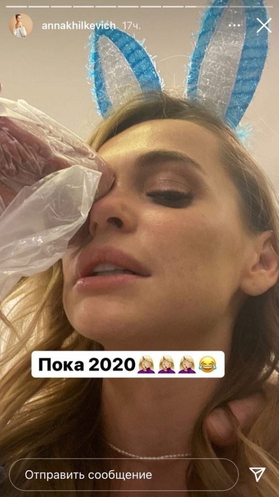 Анна Хилькевич