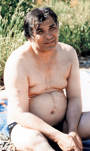 После ссоры с большегрудой буфетчицей Луизой у музыканта остался на животе огромный шрам