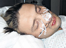 ЭДГАР: с новым носом